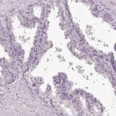 Immunohistochemistry-Paraffin: C1orf56 Antibody [NBP1-82174] - Staining of human prostate shows low expression as expected.