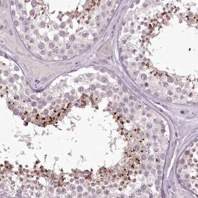 Immunohistochemistry-Paraffin: C1orf56 Antibody [NBP1-82174] - Staining of human testis shows high expression.