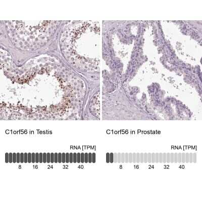 <b>Orthogonal Strategies Validation. </b>Immunohistochemistry-Paraffin: C1orf56 Antibody [NBP1-82174] - Staining in human testis and prostate tissues using anti-C1orf56 antibody. Corresponding C1orf56 RNA-seq data are presented for the same tissues.