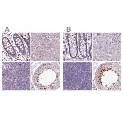 <b>Independent Antibodies Validation. </b>Immunohistochemistry-Paraffin: C1orf56 Antibody [NBP1-82174] - Staining of human colon, liver, lymph node and testis using Anti-C1orf56 antibody NBP1-82174 (A) shows similar protein distribution across tissues to independent antibody NBP2-32683 (B).