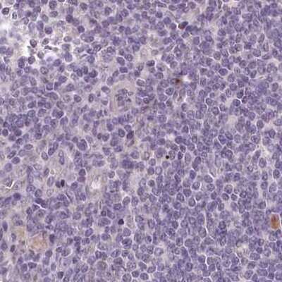 Immunohistochemistry-Paraffin: C1orf56 Antibody [NBP1-82174] - Staining of human lymph node.