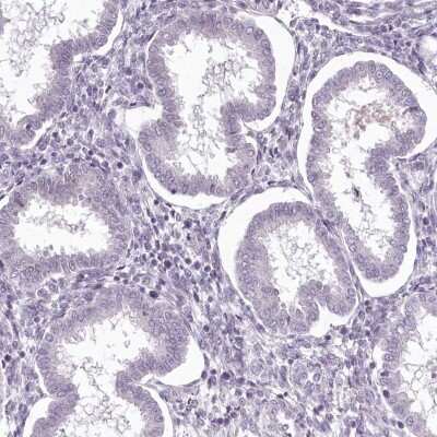 Immunohistochemistry-Paraffin: C1orf56 Antibody [NBP2-32683] - Staining of human endometrium shows low expression as expected.