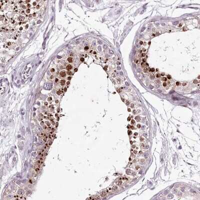 Immunohistochemistry-Paraffin: C1orf56 Antibody [NBP2-32683] - Staining of human testis shows high expression.