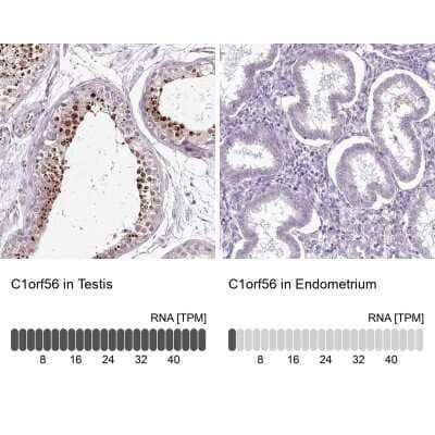 <b>Orthogonal Strategies Validation. </b>Immunohistochemistry-Paraffin: C1orf56 Antibody [NBP2-32683] - Staining in human testis and endometrium tissues using anti-C1orf56 antibody. Corresponding C1orf56 RNA-seq data are presented for the same tissues.