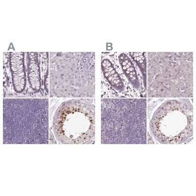 <b>Independent Antibodies Validation. </b>Immunohistochemistry-Paraffin: C1orf56 Antibody [NBP2-32683] - Staining of human colon, liver, lymph node and testis using Anti-C1orf56 antibody NBP2-32683 (A) shows similar protein distribution across tissues to independent antibody NBP1-82174 (B).