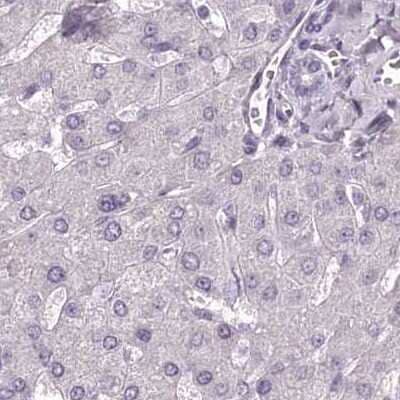 Immunohistochemistry-Paraffin: C1orf56 Antibody [NBP2-32683] - Staining of human liver.