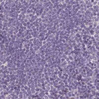 Immunohistochemistry-Paraffin: C1orf56 Antibody [NBP2-32683] - Staining of human lymph node.