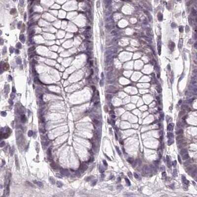 Immunohistochemistry-Paraffin: C1orf56 Antibody [NBP2-32683] - Staining of human colon.