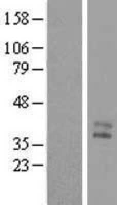 Western Blot: C1orf56 Overexpression Lysate (Adult Normal) [NBL1-08323] Left-Empty vector transfected control cell lysate (HEK293 cell lysate); Right -Over-expression Lysate for C1orf56.