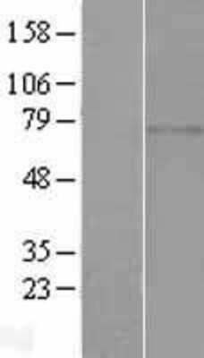 Western Blot: C1orf65 Overexpression Lysate (Adult Normal) [NBL1-08327] Left-Empty vector transfected control cell lysate (HEK293 cell lysate); Right -Over-expression Lysate for C1orf65.