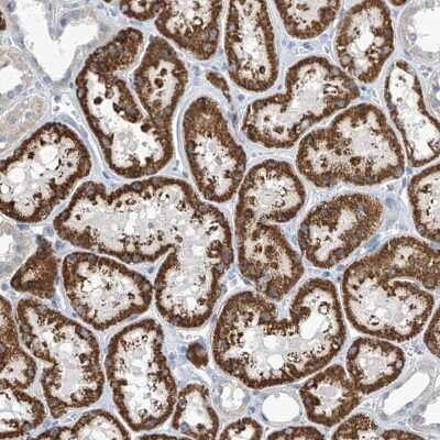 Immunohistochemistry: C1orf69 Antibody [NBP2-48594] - Staining of human kidney shows strong cytoplasmic positivity in renal tubules.