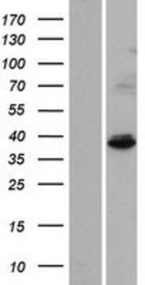Western Blot IBA57 Overexpression Lysate