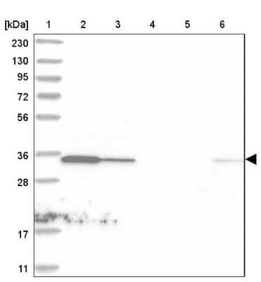 Western Blot: C1orf74 Antibody [NBP1-83571] - Lane 1: Marker  [kDa] 230, 130, 95, 72, 56, 36, 28, 17, 11.  Lane 2: Human cell line RT-4.  Lane 3: Human cell line U-251MG sp.  Lane 4: Human plasma (IgG/HSA depleted).  Lane 5: Human liver tissue.  Lane 6: Human tonsil tissue