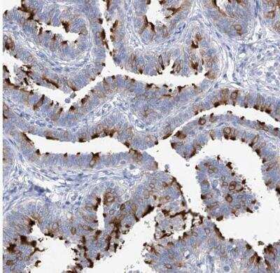 Immunohistochemistry-Paraffin: C1orf87 Antibody [NBP1-81101] - Staining of human fallopian tube shows distinct positivity in cilia.