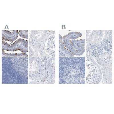 Immunohistochemistry-Paraffin: C1orf87 Antibody [NBP1-81101] - Staining of human fallopian tube, kidney, lymph node and testis using Anti-C1orf87 antibody NBP1-81101 (A) shows similar protein distribution across tissues to independent antibody NBP2-48611 (B).