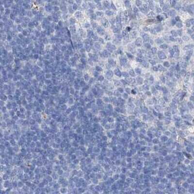 Immunohistochemistry-Paraffin: C1orf87 Antibody [NBP1-81101] - Staining of human lymph node.