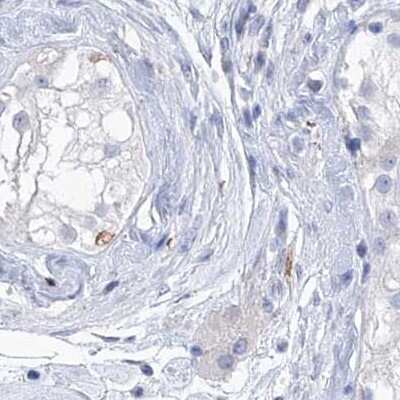 Immunohistochemistry-Paraffin: C1orf87 Antibody [NBP1-81101] - Staining of human testis.
