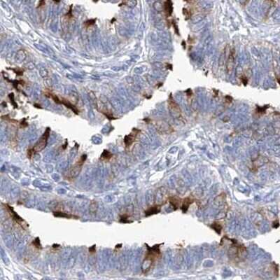 Immunohistochemistry-Paraffin: C1orf87 Antibody [NBP1-81101] - Staining of human fallopian tube.