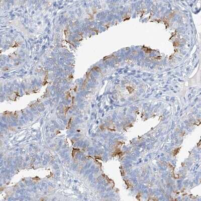Immunohistochemistry-Paraffin: C1orf87 Antibody [NBP2-48611] - Staining of human nasopharynx shows strong positivity in cilia of respiratory epithelial cells.