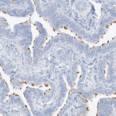 Immunohistochemistry-Paraffin: C1orf87 Antibody [NBP2-48611] - Staining of human fallopian tube shows high expression.