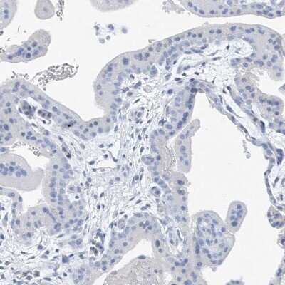 Immunohistochemistry-Paraffin: C1orf87 Antibody [NBP2-48611] - Staining of human placenta shows low expression as expected.