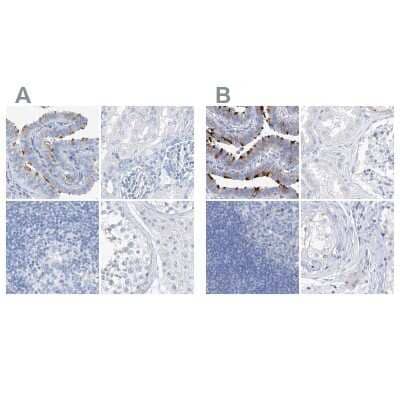 <b>Independent Antibodies Validation. </b>Immunohistochemistry-Paraffin: C1orf87 Antibody [NBP2-48611] - Staining of human fallopian tube, kidney, lymph node and testis using Anti-C1orf87 antibody NBP2-48611 (A) shows similar protein distribution across tissues to independent antibody NBP1-81101 (B).