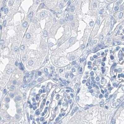 Immunohistochemistry-Paraffin: C1orf87 Antibody [NBP2-48611] - Staining of human kidney.