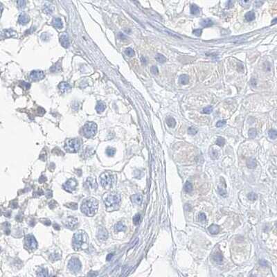 Immunohistochemistry-Paraffin: C1orf87 Antibody [NBP2-48611] - Staining of human testis.