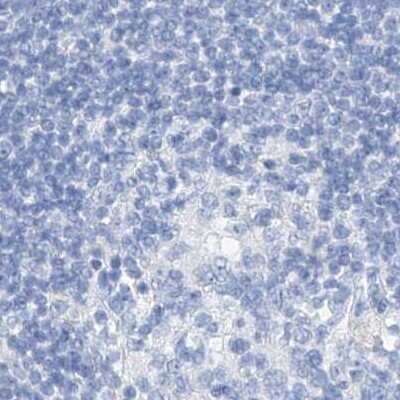 Immunohistochemistry-Paraffin: C1orf87 Antibody [NBP2-48611] - Staining of human lymph node.