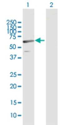 Western Blot: C1orf87 Antibody [H00127795-B01P] - Analysis of C1orf87 expression in transfected 293T cell line by C1orf87 polyclonal antibody.  Lane 1: C1orf87 transfected lysate(60.06 KDa). Lane 2: Non-transfected lysate.