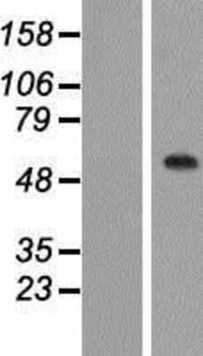 Western Blot: C1orf87 Overexpression Lysate (Adult Normal) [NBP2-05398] Left-Empty vector transfected control cell lysate (HEK293 cell lysate); Right -Over-expression Lysate for C1orf87.