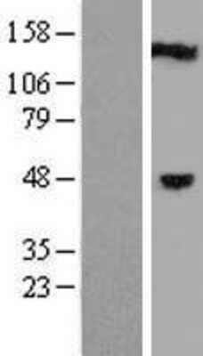 Western Blot: C1orf94 Overexpression Lysate (Adult Normal) [NBL1-08336] Left-Empty vector transfected control cell lysate (HEK293 cell lysate); Right -Over-expression Lysate for C1orf94.