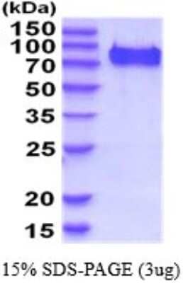 SDS-Page: Recombinant Mouse C1qR1/CD93 Protein [NBP2-52231] - 15% SDS Page (3 ug)