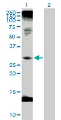 Western Blot: C1qTNF1/CTRP1 Antibody [H00114897-D01P] - Analysis of C1QTNF1 expression in transfected 293T cell line by C1QTNF1 polyclonal antibody.Lane 1: C1QTNF1 transfected lysate(31.70 KDa).Lane 2: Non-transfected lysate.