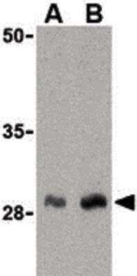 Western Blot: C1qTNF1/CTRP1 Antibody [NBP1-03120] - Western blot of C1qTNF1/CTRP1 in human kidney cell lysate with C1qTNF1/CTRP1 Antibody at (A) 1 and (B) 2 ug/ml.