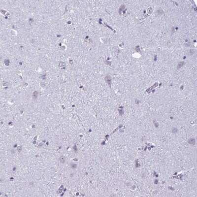 Immunohistochemistry-Paraffin: C1qTNF10/C1qL2 Antibody [NBP2-34090] - Staining of human Cerebral cortex shows weak  extracellular space positivity in neuronal cells.