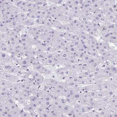 Immunohistochemistry-Paraffin: C1qTNF10/C1qL2 Antibody [NBP2-34090] - Staining of human Liver shows no positivity in hepatocytes as expected.