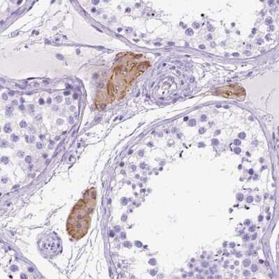 Immunohistochemistry: C1qTNF3/CORS26/CTRP3 Antibody [NBP2-49434] - Staining of human testis shows moderate cytoplasmic positivity in Leydig cells.