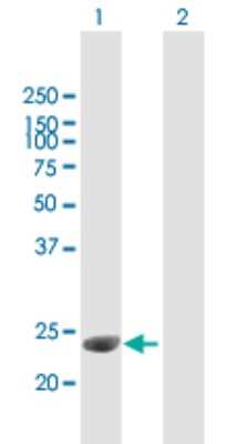 Western Blot: C1qTNF3/CORS26/CTRP3 Antibody [H00114899-B01P] - Analysis of C1QTNF3 expression in transfected 293T cell line by C1QTNF3 polyclonal antibody.  Lane 1: C1QTNF3 transfected lysate(27.06 KDa). Lane 2: Non-transfected lysate.