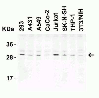 Western Blot: C1qTNF3/CORS26/CTRP3 Antibody [NBP1-76628] - Western blot analysis of CTRP3 in mouse heart cell lysate with C1qTNF3/CORS26/CTRP3 antibody at 1 ug/mL in the (A) absence and (B) presence of blocking peptide.