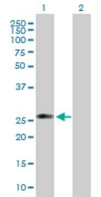 Western Blot: C1qTNF5/CTRP5 Antibody [H00114902-B01P] - Analysis of C1QTNF5 expression in transfected 293T cell line by C1QTNF5 polyclonal antibody.  Lane 1: C1QTNF5 transfected lysate(26.73 KDa). Lane 2: Non-transfected lysate.