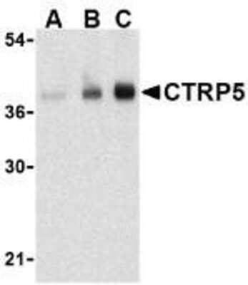 Western Blot C1qTNF5/CTRP5 Antibody - BSA Free