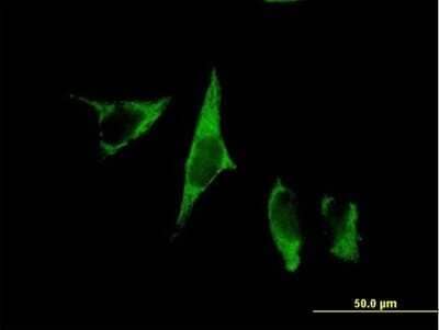 Immunocytochemistry/Immunofluorescence: C1qTNF9 Antibody [H00338872-B01P] - Analysis of purified antibody to MGC48915 on HeLa cell. (antibody concentration 10 ug/ml)