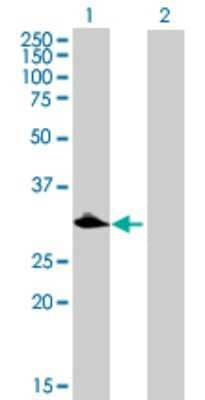 Western Blot: C1qTNF9 Antibody [H00338872-B01P] - Analysis of C1QTNF9 expression in transfected 293T cell line by C1QTNF9 polyclonal antibody.  Lane 1: MGC48915 transfected lysate(36.63 KDa). Lane 2: Non-transfected lysate.