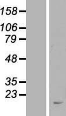 Western Blot: C20orf107 Overexpression Lysate (Adult Normal) [NBL1-08356] Left-Empty vector transfected control cell lysate (HEK293 cell lysate); Right -Over-expression Lysate for C20orf107.