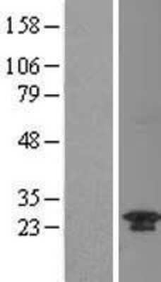 Western Blot TWA1 Overexpression Lysate