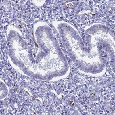 Immunohistochemistry-Paraffin: C20orf112 Antibody [NBP1-94115] - Staining of human endometrium shows low expression as expected.