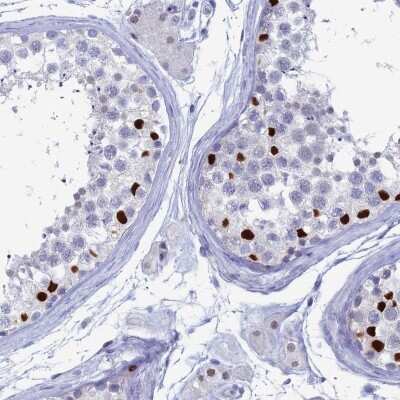 Immunohistochemistry-Paraffin: C20orf112 Antibody [NBP1-94115] - Staining of human testis shows high expression.