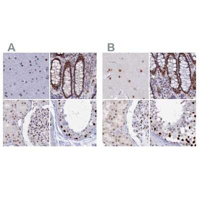 Immunohistochemistry-Paraffin: C20orf112 Antibody [NBP1-94115] - Staining of human cerebral cortex, colon, kidney and testis using Anti-NOL4L antibody NBP1-94115 (A) shows similar protein distribution across tissues to independent antibody NBP1-94114 (B).
