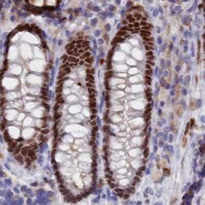 Immunohistochemistry-Paraffin: C20orf112 Antibody [NBP1-94115] - Staining of human colon.